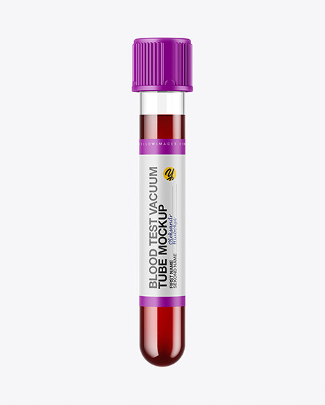Blood Test Tube Mockup
